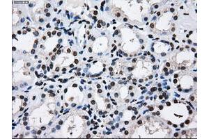 Image no. 7 for anti-Replication Protein A2, 32kDa (RPA2) antibody (ABIN1500736) (RPA2 anticorps)