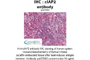 Image no. 1 for anti-Baculoviral IAP Repeat Containing 3 (BIRC3) (AA 314-508) antibody (ABIN1733088) (BIRC3 anticorps  (AA 314-508))
