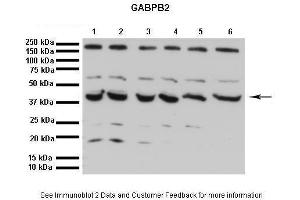Lanes:   1. (GABPB2 anticorps  (C-Term))