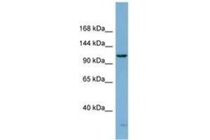Image no. 1 for anti-DEAH (Asp-Glu-Ala-His) Box Polypeptide 15 (DHX15) (AA 107-156) antibody (ABIN6741862) (DHX15 anticorps  (AA 107-156))