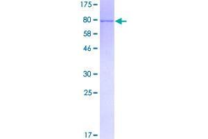 SDS-PAGE (SDS) image for FYN Oncogene Related To SRC, FGR, YES (FYN) (AA 1-482) protein (GST tag) (ABIN1354567)