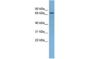 WB Suggested Anti-NDUFS1 Antibody Titration: 0. (NDUFS1 anticorps  (Middle Region))