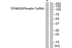 Western blot analysis of extracts from JK cells, using EPHA2/5 (Phospho-Tyr594) Antibody. (EPHA2/5 (pTyr594) anticorps)