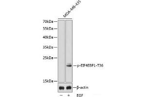 Western blot analysis of extracts from MDA-MB-435 cells using Phospho-EIF4EBP1(T36) Polyclonal Antibody. (eIF4EBP1 anticorps  (pThr36))