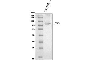 Western blot analysis of CD39/ENTPD1 using anti-CD39/ENTPD1 antibody (ABIN7602461).