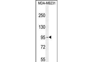 KCNT2 Antibody (C-term) (ABIN654309 and ABIN2844095) western blot analysis in MDA-M cell line lysates (35 μg/lane). (KCNT2 anticorps  (C-Term))