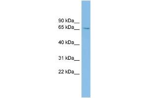 WB Suggested Anti-SLC6A1 Antibody Titration: 0. (SLC6A1 anticorps  (Middle Region))