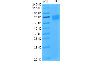 Biotinylated Human IL-17R alpha on Tris-Bis PAGE under reduced condition.