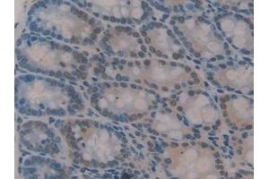 Detection of GLI3 in Mouse Colon Tissue using Polyclonal Antibody to GLI Family Zinc Finger Protein 3 (GLI3)