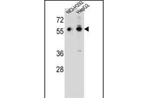 TRIM64 Antibody (C-term) (ABIN657217 and ABIN2837912) western blot analysis in NCI-,HepG2 cell line lysates (35 μg/lane). (TRIM64 anticorps  (C-Term))