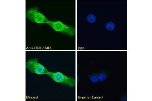 ABIN334426 Immunofluorescence analysis of paraformaldehyde fixed A431 cells, permeabilized with 0.