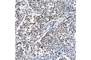IHC analysis of SF3A1 using anti-SF3A1 antibody (ABIN7600556). (SF3A1 anticorps  (AA 20-556))