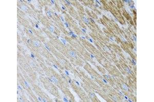 Immunohistochemistry of paraffin-embedded Mouse heart using MTX2 Polyclonal Antibody at dilution of 1:100 (40x lens). (MTX2 anticorps)