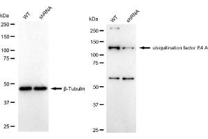 Western blotting analysis using ubiquitination factor E4 A antibody (ABIN7800764). (Recombinant UBE4A anticorps)