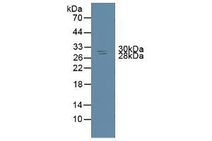 Detection of NME6 in Rat Spleen Tissue using Polyclonal Antibody to Non Metastatic Cells 6, Protein Expressed In (NME6)