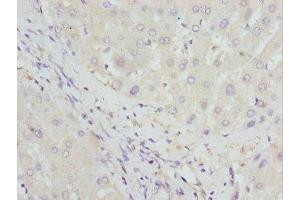 Immunohistochemistry of paraffin-embedded human liver tissue using ABIN7154996 at dilution of 1:100 (HBZ anticorps  (AA 1-142))