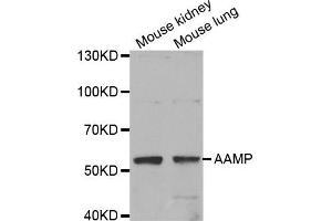Western Blotting (WB) image for anti-Angio-Associated, Migratory Cell Protein (AAMP) antibody (ABIN1875463) (AAMP anticorps)