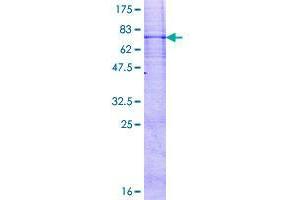 Image no. 1 for Ring Finger Protein 26 (RNF26) (AA 1-433) protein (GST tag) (ABIN1318366)
