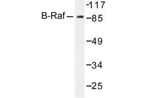 Image no. 2 for anti-B-Raf proto-oncogene, serine/threonine kinase (BRAF) antibody (ABIN271999) (BRAF anticorps)