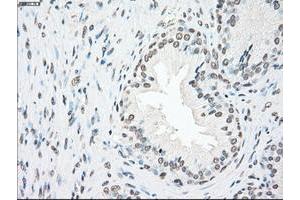 Image no. 3 for anti-Polo-Like Kinase 1 (PLK1) antibody (ABIN1500283)