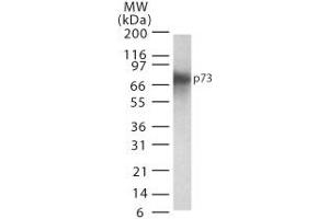 p73 Western Blot. (Tumor Protein p73 anticorps)