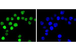 SW480 cells were stained with Cyclin E1(T77) (4G10 ) Monoclonal Antibody  at [1:200] incubated overnight at 4C, followed by secondary antibody incubation, DAPI staining of the nuclei and detection. (Cyclin E1 anticorps  (pThr77))