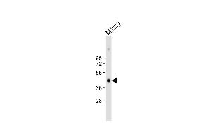 Anti-Mouse Plau Antibody (C-term) at 1:1000 dilution + mouse lung lysate Lysates/proteins at 20 μg per lane.