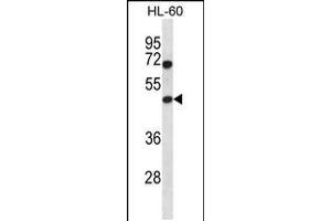 Western blot analysis in HL-60 cell line lysates (35ug/lane). (HAT1 anticorps  (N-Term))