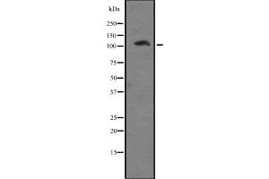 Western blot analysis of EIF4G2 expression in A431 whole cell lysate ,The lane on the left is treated with the antigen-specific peptide. (EIF4G2 anticorps  (N-Term))