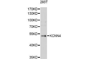 Western blot analysis of extracts of 293T cells, using KCNN4 antibody (ABIN5971024) at 1/1000 dilution. (KCNN4 anticorps)