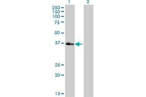 Western Blot analysis of POU4F3 expression in transfected 293T cell line by POU4F3 monoclonal antibody (M01), clone 5B8.