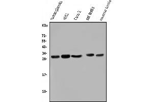 Western blot analysis of LIN28A using anti-LIN28A antibody (ABIN7601176).