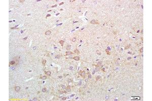 Formalin-fixed and paraffin embedded rat brain tissue labeled with Anti-Synaptotagmin 1/SYT1 Polyclonal Antibody, Unconjugated  at 1:200 followed by conjugation to the secondary antibody, (SP-0023), and DAB staining