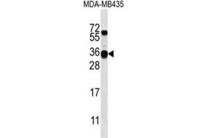 Western Blotting (WB) image for anti-Casein beta (CSN2) antibody (ABIN2996884) (CSN2 anticorps)