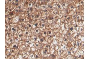 DAB staining on IHC-P; Samples: Human Liver Tissue (HPR anticorps  (AA 102-347))