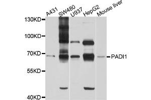 Western blot analysis of extracts of various cell lines, using PADI1 antibody (ABIN6003843) at 1/1000 dilution.