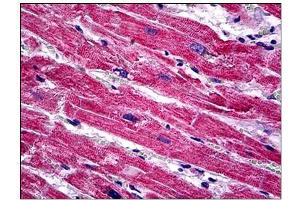 Immunohistochemistry (IHC) image for anti-Sprouty Homolog 1, Antagonist of FGF Signaling (SPRY1) antibody (ABIN781897)