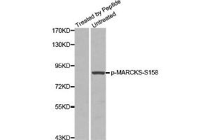 Western Blotting (WB) image for anti-Myristoylated Alanine-Rich Protein Kinase C Substrate (MARCKS) (pSer158) antibody (ABIN1870416) (MARCKS anticorps  (pSer158))