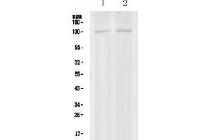 Western blot analysis of PSD using anti-PSD antibody . (PSD anticorps  (AA 536-803))