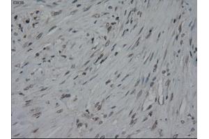 Immunohistochemical staining of paraffin-embedded colon using anti-IL-3 (ABIN2452543) mouse monoclonal antibody. (IL-3 anticorps  (AA 20-152))