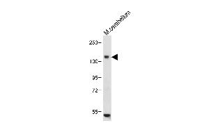 Anti-c-KIT Antibody (N-term) at 1:1000 dilution+ Mouse cerebellum tissue lysate Lysates/proteins at 20 μg per lane.