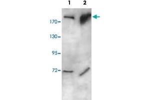 Western blot analysis of human fetal brain (Lane 1) and human fetal liver (Lane 2) lysate with SOS1 polyclonal antibody  at 1 : 1000 dilution. (SOS1 anticorps  (N-Term))