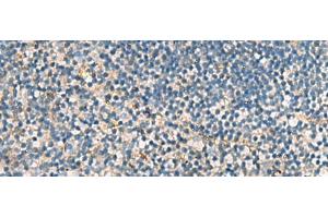 Immunohistochemistry of paraffin-embedded Human tonsil tissue using ACTC1 Polyclonal Antibody at dilution of 1:55(x200) (ACTC1 anticorps)