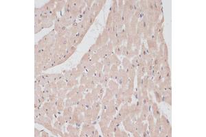 Immunohistochemistry of paraffin-embedded rat heart using PRPF31 antibody (ABIN6132996, ABIN6146262, ABIN6146264 and ABIN6221399) at dilution of 1:100 (40x lens). (PRPF31 anticorps  (AA 1-200))