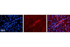 Rabbit Anti-ASGR2 Antibody   Formalin Fixed Paraffin Embedded Tissue: Human Liver Tissue Observed Staining: Plasma membrane in endothelial cells in lymphatic vessel Primary Antibody Concentration: 1:100 Other Working Concentrations: N/A Secondary Antibody: Donkey anti-Rabbit-Cy3 Secondary Antibody Concentration: 1:200 Magnification: 20X Exposure Time: 0.
