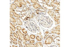 IHC analysis of Renin/REN using anti-Renin/REN antibody (ABIN7602836).