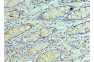 Immunohistochemistry of paraffin-embedded human colon tissue using ABIN7154290 at dilution of 1:100 (GOLM1 anticorps  (AA 112-401))