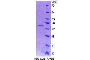 SDS-PAGE (SDS) image for Ninein (GSK3B Interacting Protein) (NIN) (AA 1-153) protein (His tag) (ABIN4989447) (Ninein Protein (AA 1-153) (His tag))