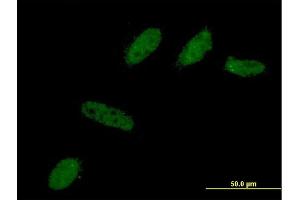 anti-BCL2-Like 12 (Proline Rich) (BCL2L12) (AA 174-273) antibody