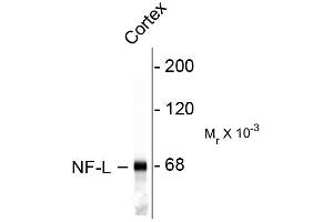 Western blots of rat cortex lysate showing specific immunolableing of the ~ 68k NF-L protein. (NEFL anticorps)
